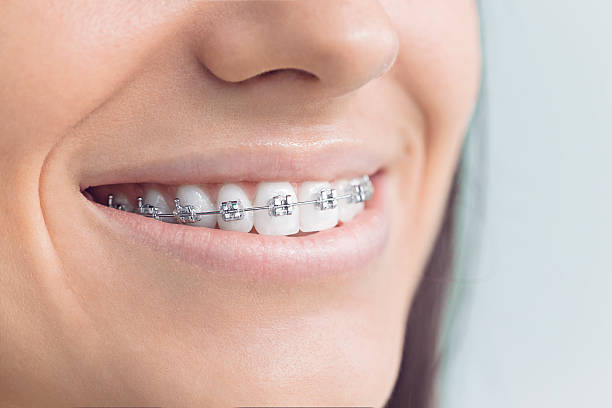 Best Dental Inlays and Onlays  in Bacliff, TX